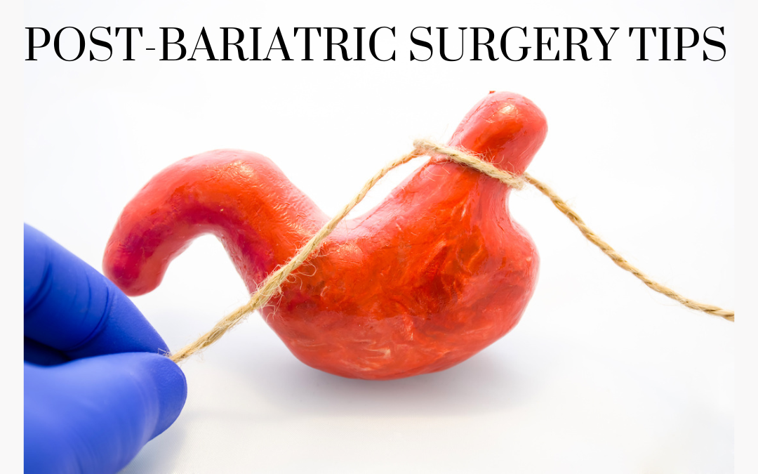 Four Tips for Adapting to Life After Bariatric Surgery Adriana Albritton